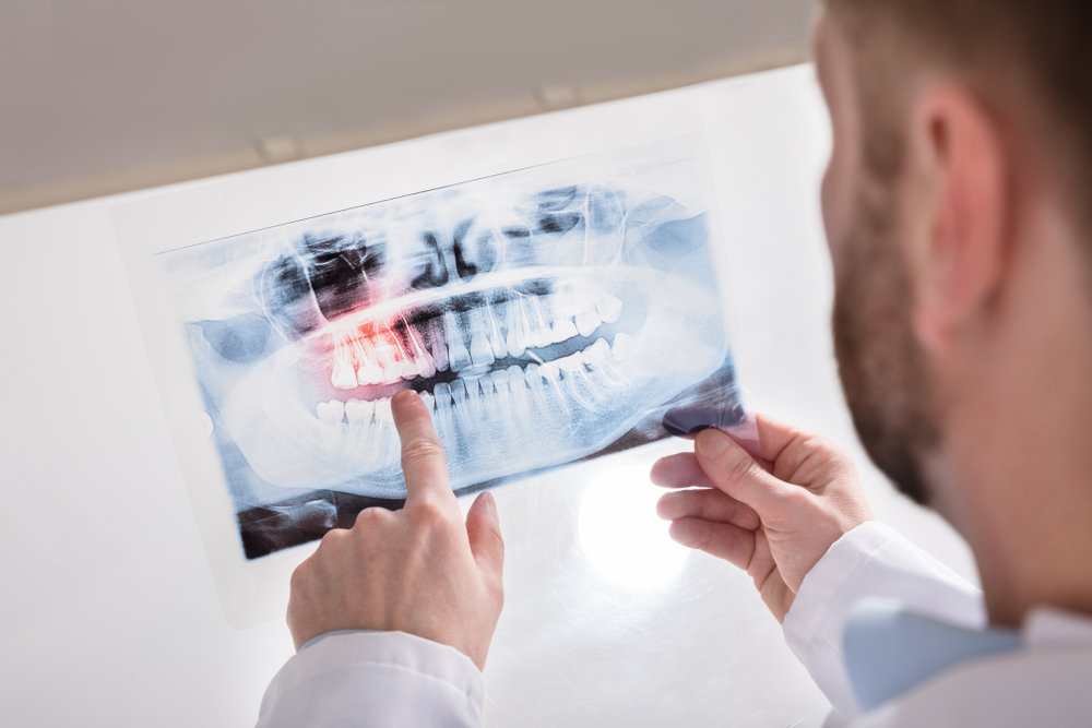 What's Best Procedure Root Canal Treatment