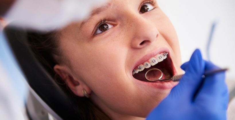 4 Signs Your Child Needs Braces
